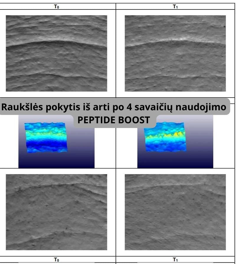 MAXI: Peptidų rinkinys pilnai odos regeneracijai