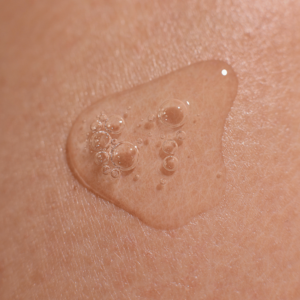 Serumas porų ir riebaluotumo mažinimui NIACINAMIDE+