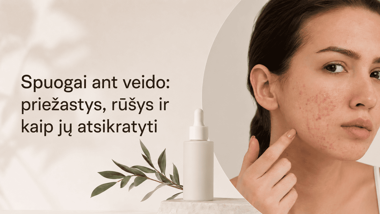 Spuogai ant veido: priežastys, rūšys ir kaip jų atsikratyti